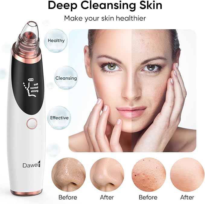 BlackClear Pro – Extractor Facial Recargable