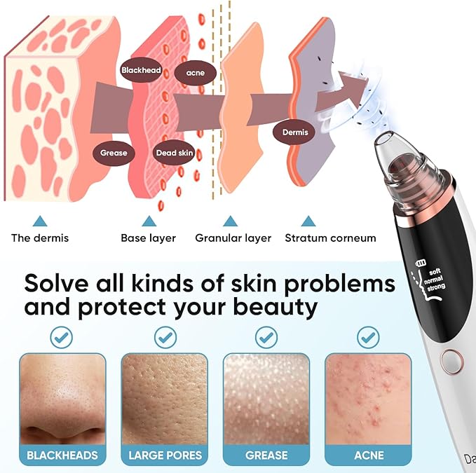 BlackClear Pro – Extractor Facial Recargable