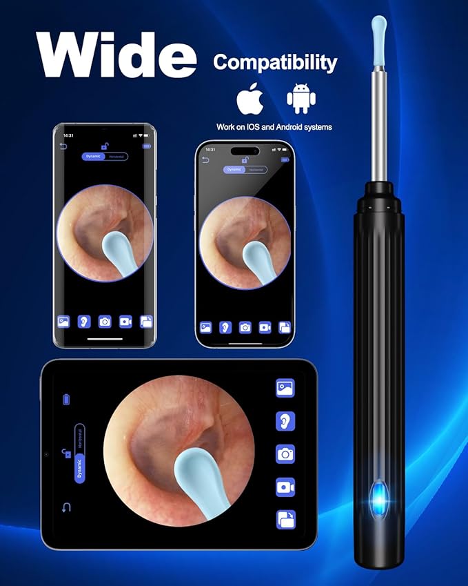 EarView Pro – Limpiador de Oídos con Cámara HD