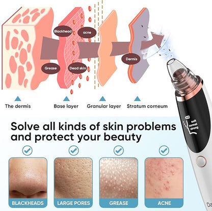 BlackClear Pro – Extractor Facial Recargable